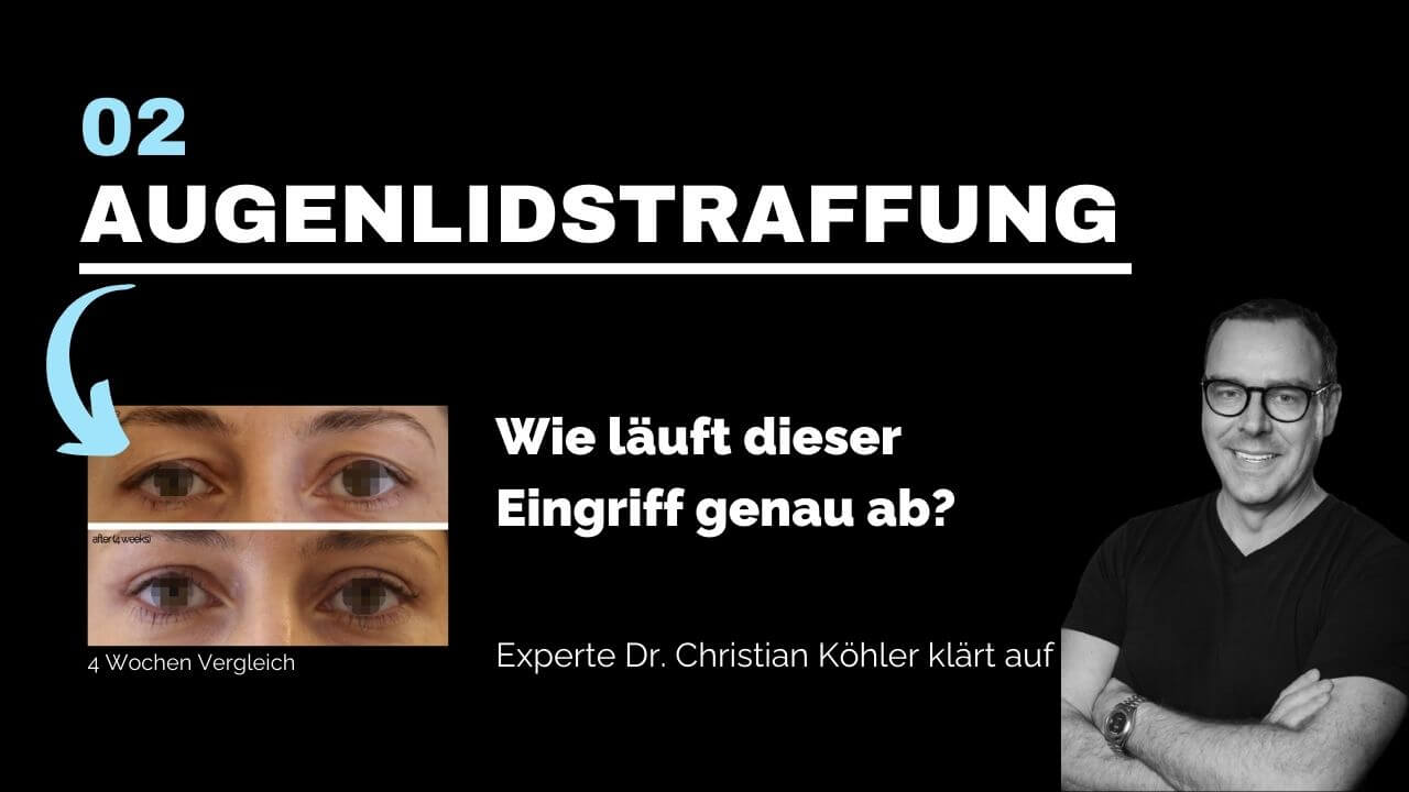 Augenlidstraffung, prevention-center für Schönheitschirurgie in St. Gallen