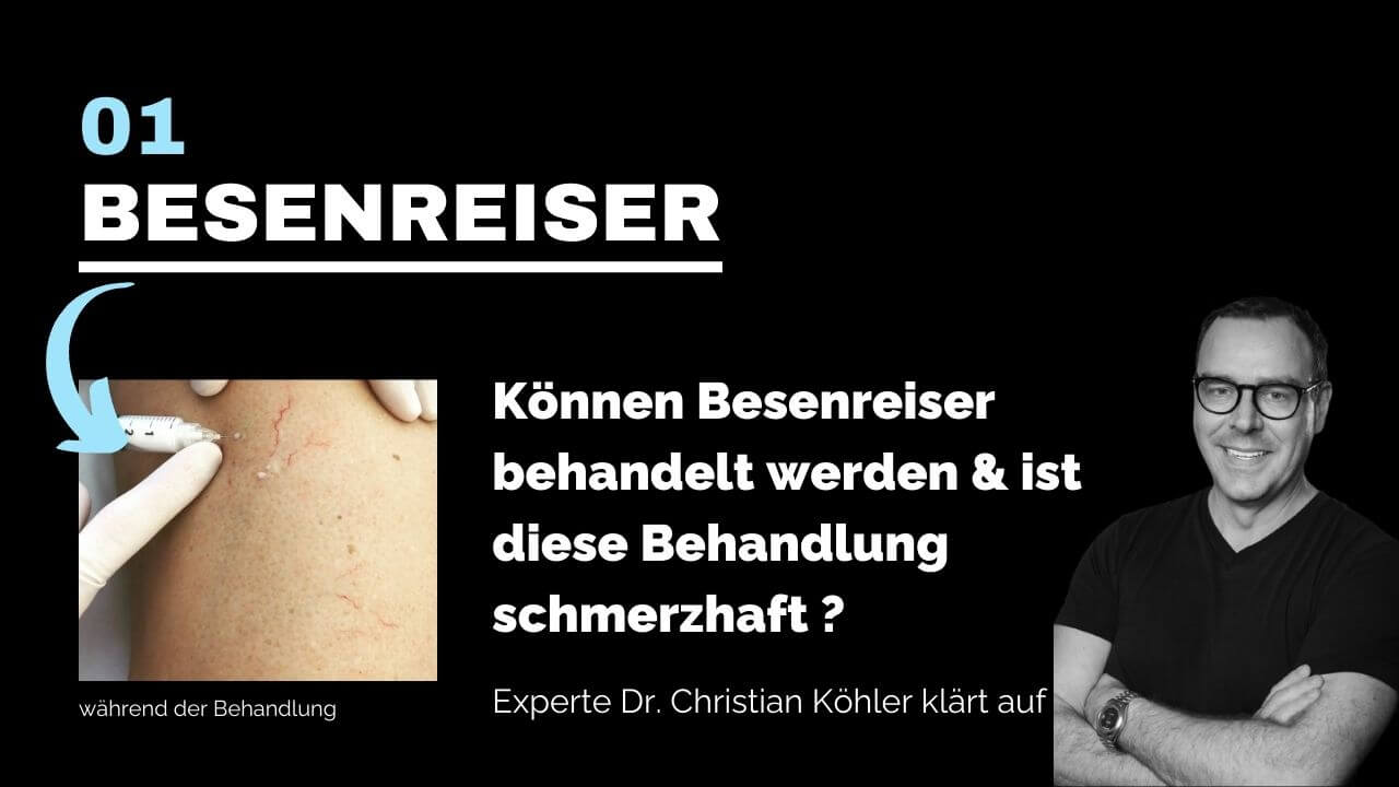 Besenreiser entfernen, prevention-center für Schönheitschirurgie in St. Gallen