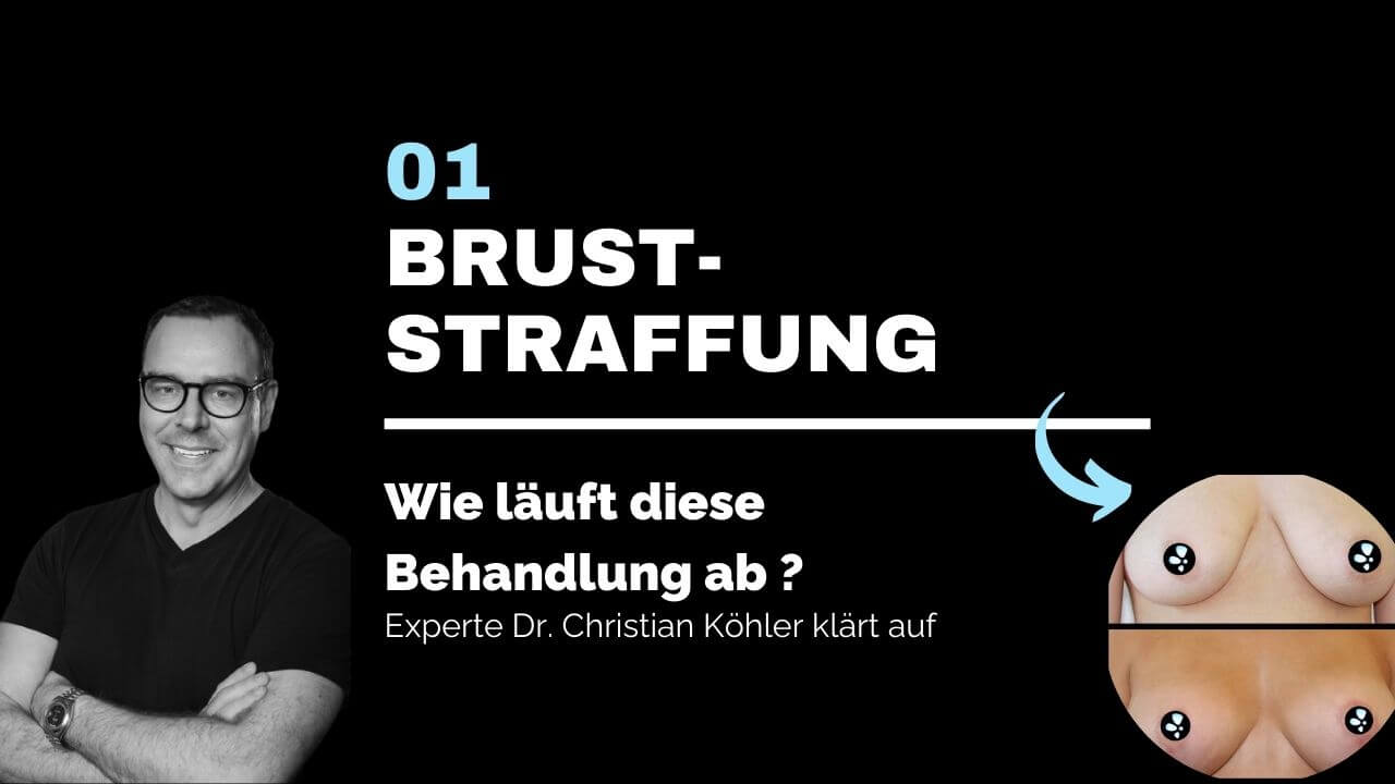 Bruststraffung, prevention-center für Schönheitschirurgie in St. Gallen