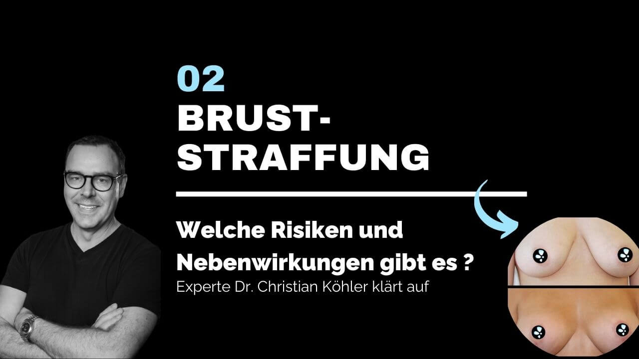 Bruststraffung, prevention-center für Schönheitschirurgie in St. Gallen